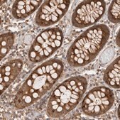 Anti-VPS28 antibody produced in rabbit Prestige Antibodies&#174; Powered by Atlas Antibodies, affinity isolated antibody, buffered aqueous glycerol solution, Ab1