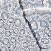 Anti-TPX2 antibody produced in rabbit Prestige Antibodies&#174; Powered by Atlas Antibodies, affinity isolated antibody, buffered aqueous glycerol solution