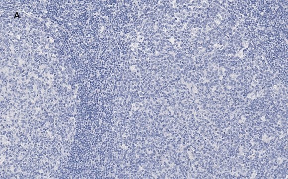 Anti-NF-kB p50/105 Antibody, clone 1N19, ZooMAb&#174; Rabbit Monoclonal recombinant, expressed in HEK 293 cells