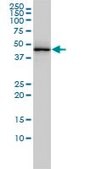 Monoclonal Anti-TARDBP antibody produced in mouse clone 2E2-D3, purified immunoglobulin, buffered aqueous solution