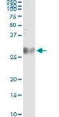 Monoclonal Anti-DSU antibody produced in mouse clone 8F9-1B2, purified immunoglobulin, buffered aqueous solution