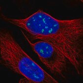 Anti-RPP38 antibody produced in rabbit Prestige Antibodies® Powered by Atlas Antibodies, affinity isolated antibody, buffered aqueous glycerol solution