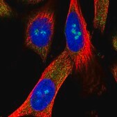 Anti-METTL5 antibody produced in rabbit Prestige Antibodies&#174; Powered by Atlas Antibodies, affinity isolated antibody, buffered aqueous glycerol solution