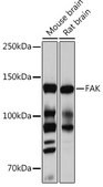 Anti-FAK Antibody, clone 7H8C4, Rabbit Monoclonal