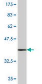 Monoclonal Anti-ORF1-FL49 antibody produced in mouse clone 4E11, purified immunoglobulin, buffered aqueous solution