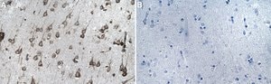 Anti-MAP3K8 Antibody, clone 1D11 ZooMAb&#174; Rabbit Monoclonal recombinant, expressed in HEK 293 cells