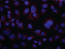 Anti-CT-Pro ET1&nbsp;(Internal)&nbsp; antibody produced in rabbit affinity isolated antibody