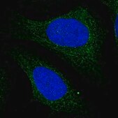 Anti-C1orf123 antibody produced in rabbit Prestige Antibodies&#174; Powered by Atlas Antibodies, affinity isolated antibody, buffered aqueous glycerol solution