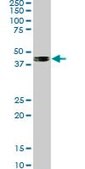 Monoclonal Anti-SMAD7 antibody produced in mouse clone 4E1, purified immunoglobulin, buffered aqueous solution