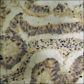 Anti-phospho-p70 S6 Kinase (pThr229) antibody produced in rabbit affinity isolated antibody