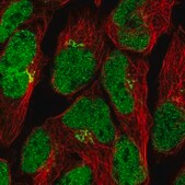 Anti-ZNF576 antibody produced in rabbit Prestige Antibodies® Powered by Atlas Antibodies, affinity isolated antibody, buffered aqueous glycerol solution