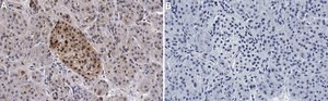 Anti-ACLY Antibody, clone 1B16 ZooMAb&#174; Rabbit Monoclonal recombinant, expressed in HEK 293 cells