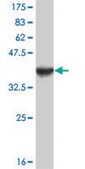 Monoclonal Anti-FOXA1 antibody produced in mouse clone 2D7, purified immunoglobulin, buffered aqueous solution