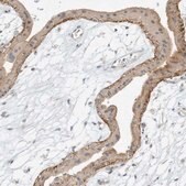 Anti-PAK6 antibody produced in rabbit Prestige Antibodies® Powered by Atlas Antibodies, affinity isolated antibody, buffered aqueous glycerol solution