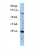 Anti-RAD51 antibody produced in rabbit affinity isolated antibody