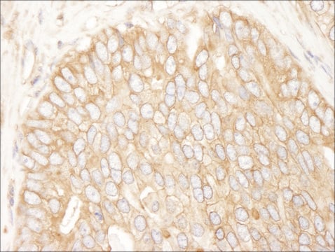 Mouse anti-Rictor Monoclonal Antibody, Affinity Purified Powered by Bethyl Laboratories, Inc., clone IG3P2C9