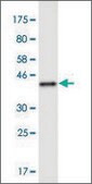 Monoclonal Anti-RNF6, (N-terminal) antibody produced in mouse clone 6D5, purified immunoglobulin, buffered aqueous solution