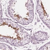 Anti-CYLC1 antibody produced in rabbit Prestige Antibodies&#174; Powered by Atlas Antibodies, affinity isolated antibody