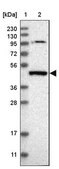 Anti-PGLYRP3 antibody produced in rabbit Prestige Antibodies® Powered by Atlas Antibodies, affinity isolated antibody, buffered aqueous glycerol solution