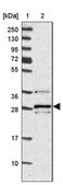 Anti-VTI1B antibody produced in rabbit Prestige Antibodies&#174; Powered by Atlas Antibodies, affinity isolated antibody, buffered aqueous glycerol solution