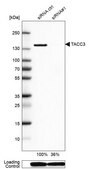Anti-TACC3 antibody produced in rabbit Prestige Antibodies&#174; Powered by Atlas Antibodies, affinity isolated antibody, buffered aqueous glycerol solution