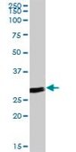 Anti-ANP32B antibody produced in mouse IgG fraction of antiserum, buffered aqueous solution