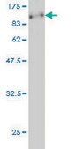 Monoclonal Anti-CARF antibody produced in mouse clone 2E6, purified immunoglobulin, buffered aqueous solution