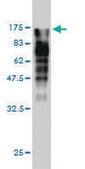 Monoclonal Anti-MVP antibody produced in mouse clone 2H3-1A6, purified immunoglobulin, buffered aqueous solution