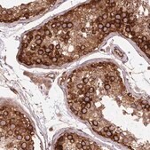 Anti-SEPT10 antibody produced in rabbit Prestige Antibodies&#174; Powered by Atlas Antibodies, affinity isolated antibody, buffered aqueous glycerol solution