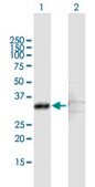 Anti-SCP2 antibody produced in mouse purified immunoglobulin, buffered aqueous solution