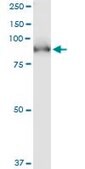 Monoclonal Anti-PDE5A antibody produced in mouse clone 1F11, purified immunoglobulin, buffered aqueous solution