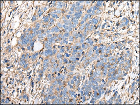 Anti-PLA2G16 affinity isolated antibody