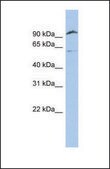 Anti-TMPRSS6 affinity isolated antibody