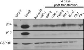 Anti-p16 Antibody, clone D25 clone D25, Chemicon&#174;, from mouse