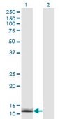 Monoclonal Anti-CRABP2 antibody produced in mouse clone 4F2, purified immunoglobulin, buffered aqueous solution
