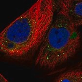 Anti-SMYD4 antibody produced in rabbit Prestige Antibodies&#174; Powered by Atlas Antibodies, affinity isolated antibody, buffered aqueous glycerol solution