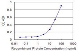 ANTI-FOXM1 antibody produced in mouse clone 2H4, purified immunoglobulin, buffered aqueous solution
