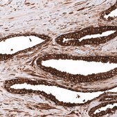 Monoclonal Anti-ALDH1A3 antibody produced in mouse Prestige Antibodies&#174; Powered by Atlas Antibodies, clone CL11968, purified immunoglobulin, buffered aqueous glycerol solution