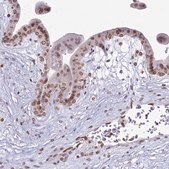 Anti-DHX37 antibody produced in rabbit Prestige Antibodies&#174; Powered by Atlas Antibodies, affinity isolated antibody, buffered aqueous glycerol solution