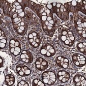 Anti-ZSWIM8 antibody produced in rabbit Prestige Antibodies&#174; Powered by Atlas Antibodies, affinity isolated antibody, buffered aqueous glycerol solution