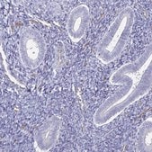 Anti-ACSBG2 antibody produced in rabbit Prestige Antibodies&#174; Powered by Atlas Antibodies, affinity isolated antibody, buffered aqueous glycerol solution