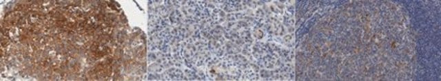 Anti-Src-Like-Adaptor 2 (SLA2) Antibody, clone Z30P1F12*F4 clone Z30P1F12*F4, from mouse