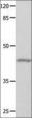 Anti-GNA11 antibody produced in rabbit affinity isolated antibody