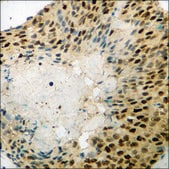 Anti-phospho-FKHR (pSer256) antibody produced in rabbit affinity isolated antibody