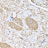 Anti- APP antibody produced in rabbit