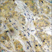 Anti-phospho-Stathmin 1 (pSer15) antibody produced in rabbit affinity isolated antibody