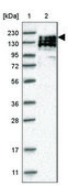 Anti-TEX14 antibody produced in rabbit Prestige Antibodies® Powered by Atlas Antibodies, affinity isolated antibody, buffered aqueous glycerol solution