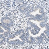 Anti-PRSS21 antibody produced in rabbit Prestige Antibodies&#174; Powered by Atlas Antibodies, affinity isolated antibody, buffered aqueous glycerol solution