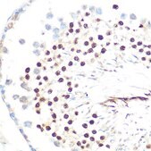 Anti-HP1 alpha/CBX5 antibody produced in rabbit