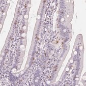 Anti-CD69 antibody produced in rabbit Prestige Antibodies&#174; Powered by Atlas Antibodies, affinity isolated antibody, buffered aqueous glycerol solution